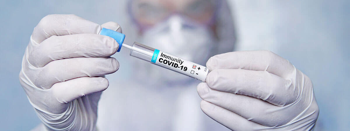 COVID-19 Antibody