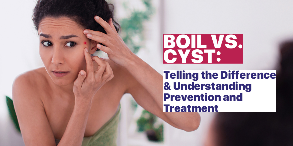 Boil vs. Cyst: Telling the Difference & Understanding Prevention and  Treatment | Blog 