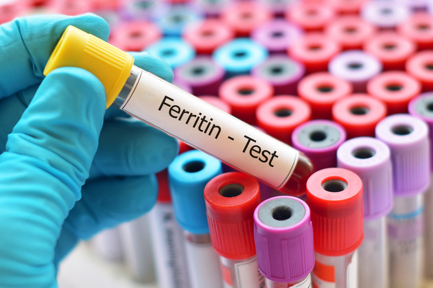 optimal ferritin levels for females