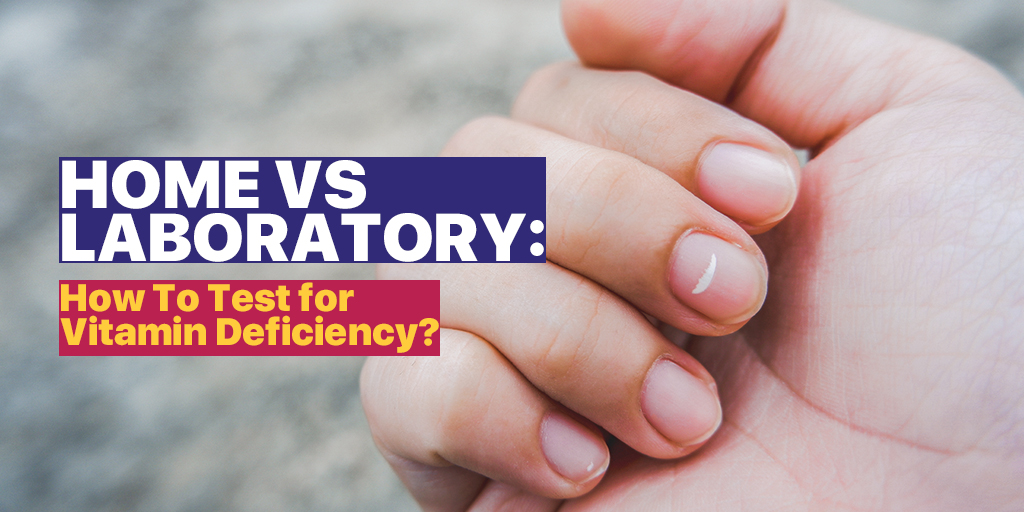 Home vs. Laboratory Vitamin & Mineral Deficiency Test: What's the Better  Choice? | Blog 