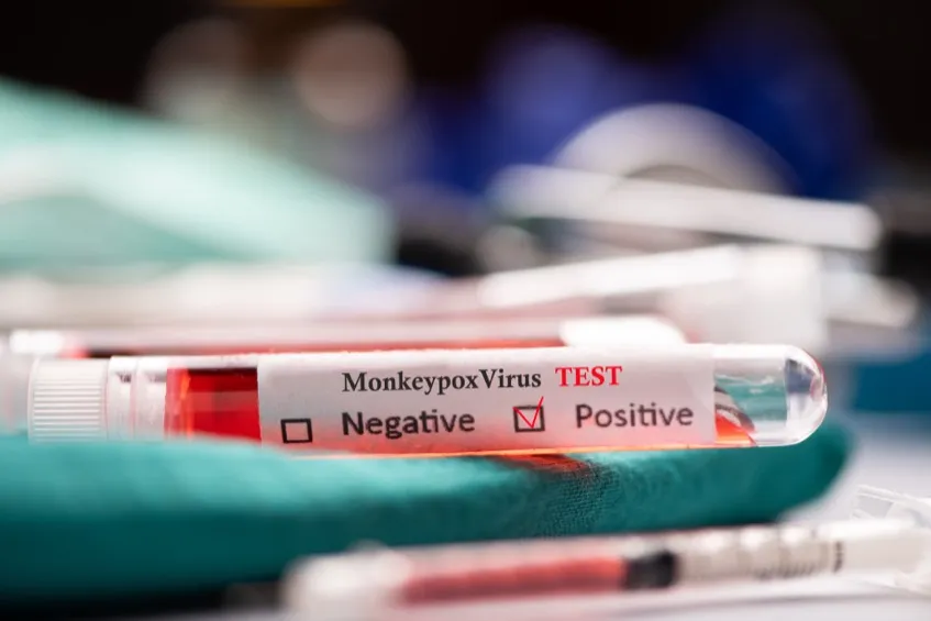 monkeypox testing