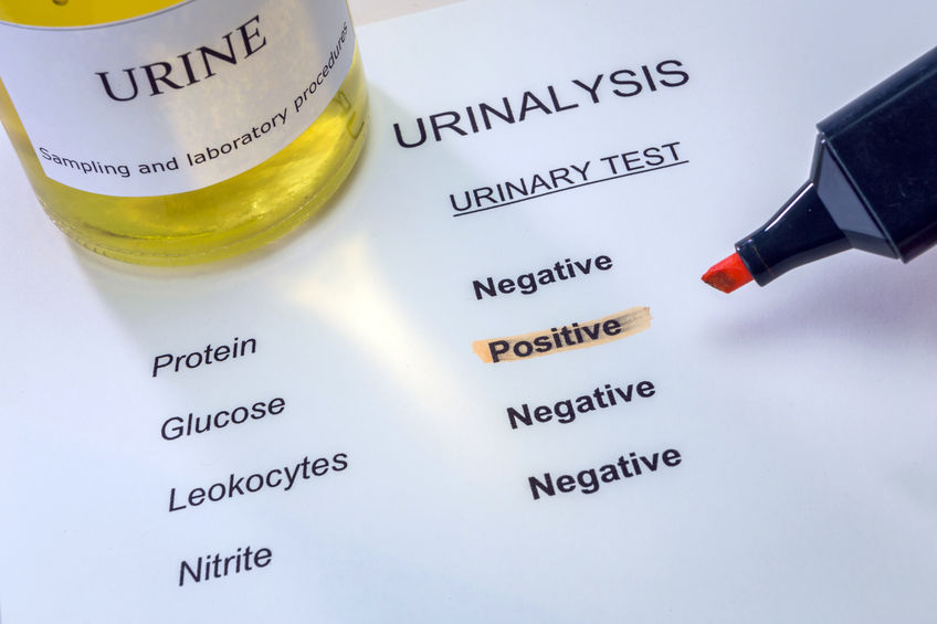 sugar in urine treatment