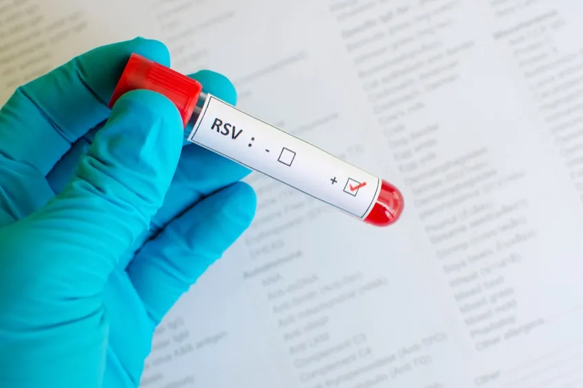 how do you test for rsv