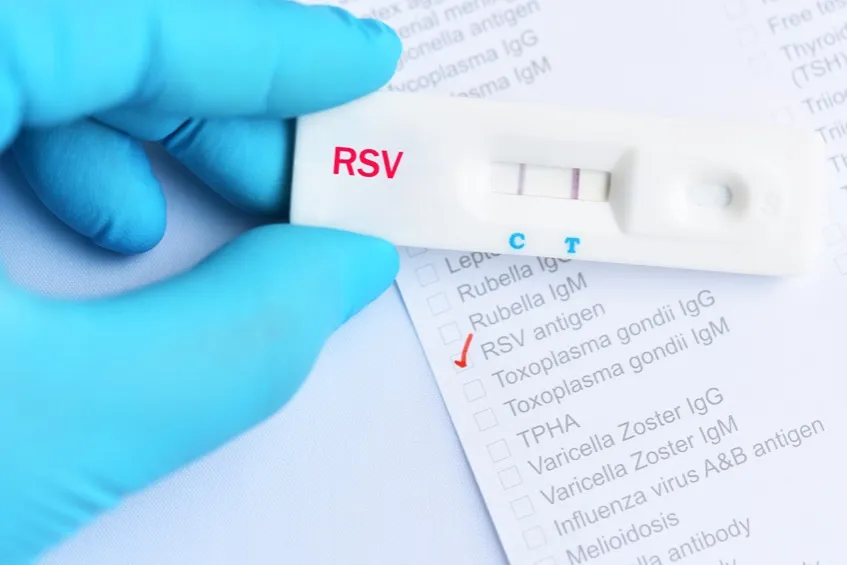 how long does an rsv test take